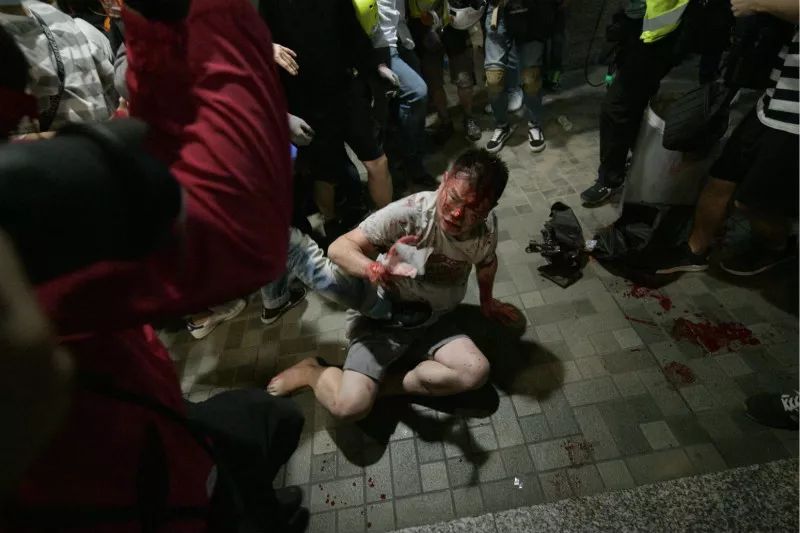 昨晚，香港太古城發生不明身份男子持刀砍人事件，區議員被咬掉耳朵-信用报告-工商信息-启信宝-企一网
