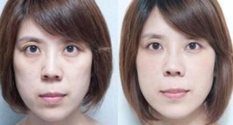 上千元的眼霜和50元的眼霜，差别到底在哪？柜姐悄悄透露，太扎心