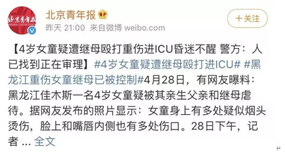 4岁女童遭生父虐打进ICU