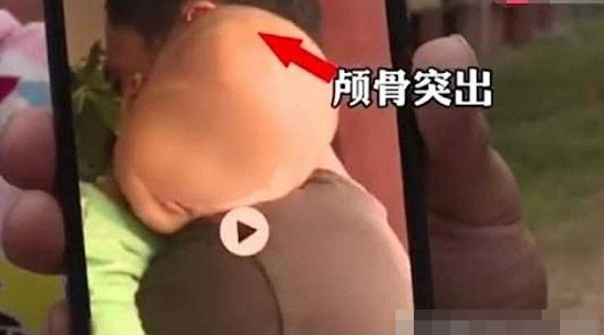 湖南“大头娃娃”事件处置结果 湖南“大头娃娃”事件处置结果