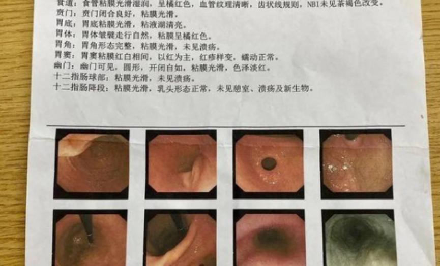 员工被罚吃死神辣条，事后被送医院治疗