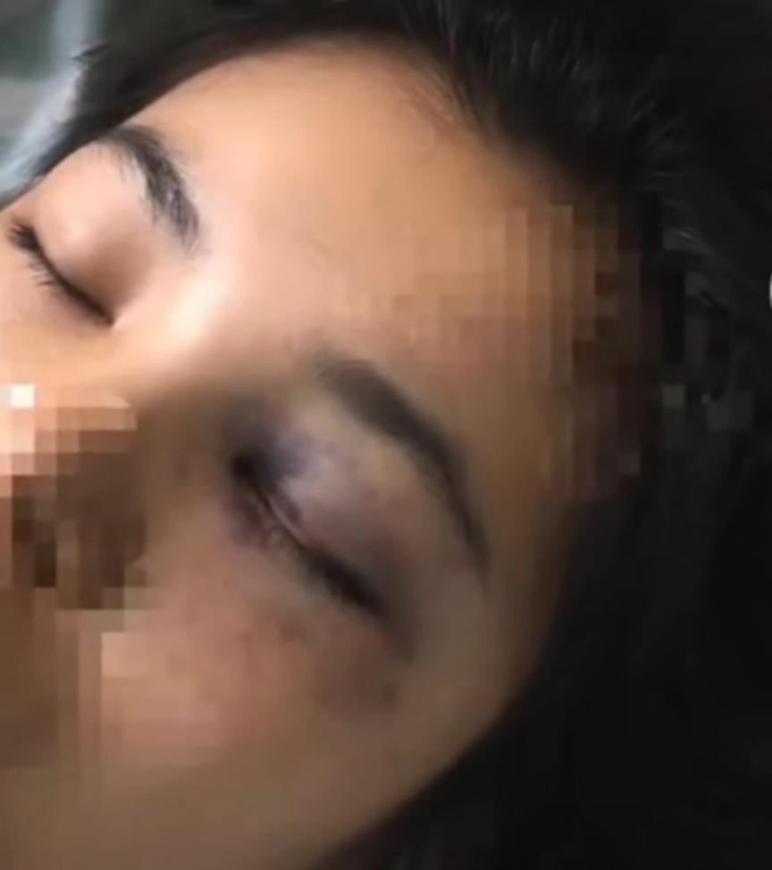 河南一女子被丈夫家暴，不得不跳楼求生，全身多处骨折