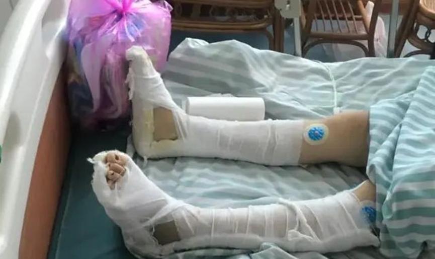女子忍受不了家暴，从二楼一跃而下躲避家暴，却不想导致自己截瘫