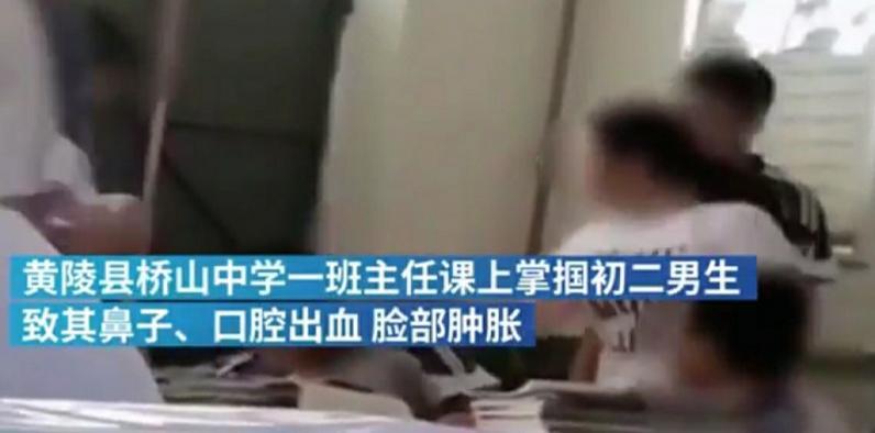 学生不听话，老师怒打致其受伤，现已被停职