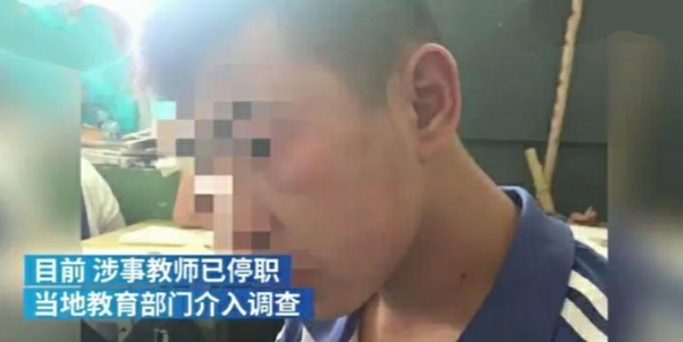 学生不听话，老师怒打致其受伤，现已被停职
