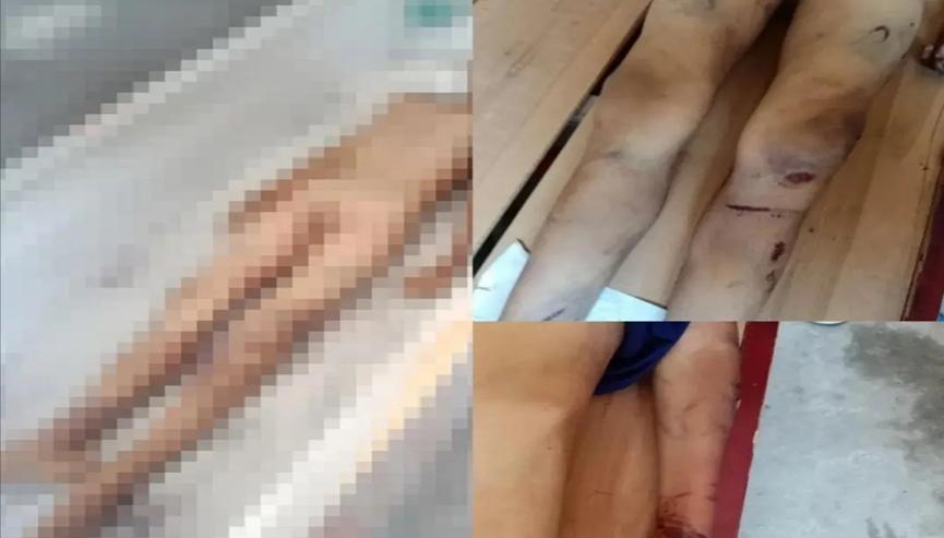 父母下手没有轻重，对孩子非打即骂，还想逃脱法律制裁
